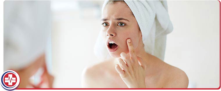 Acne Treatment Near Me in Merced, CA Acne Treatment Near Me in Merced, CA