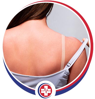 Sunburn Treatment Specialist Near Me in Merced, CA