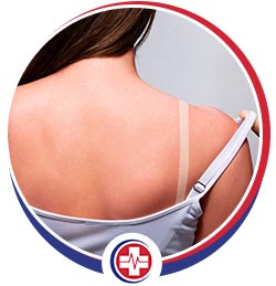 Sunburn Treatment Specialist Near Me in Merced, CA